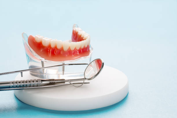 Dental Bonding in Palermo, CA